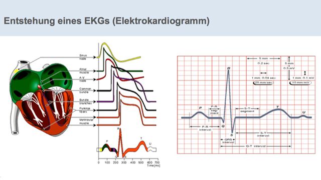 Entwicklung von medizinischen Algorithmen für die Kardiologie gestern und heute